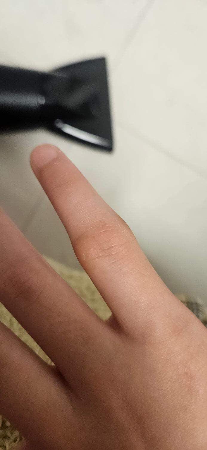 2번 째 사진