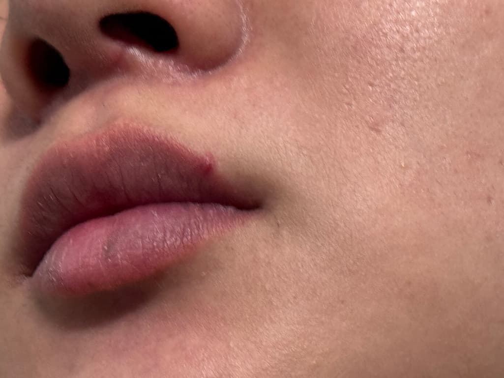 4번 째 사진