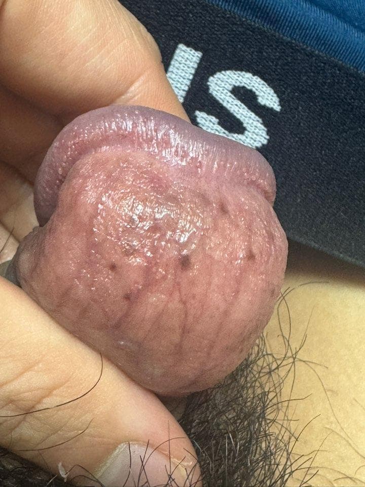 2번 째 사진