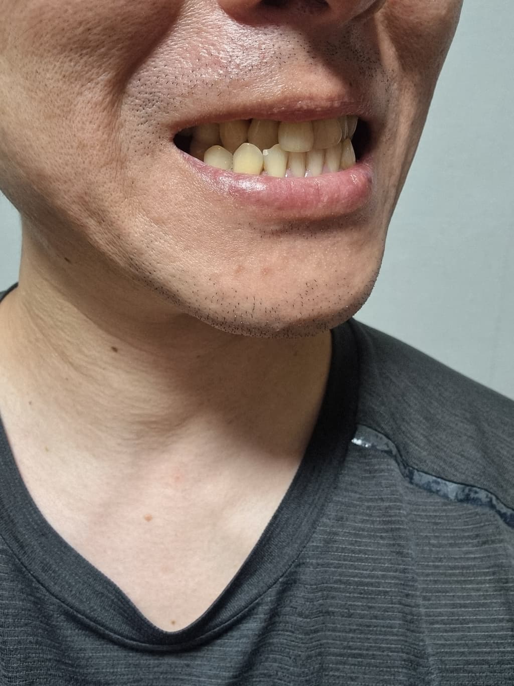 1번 째 사진