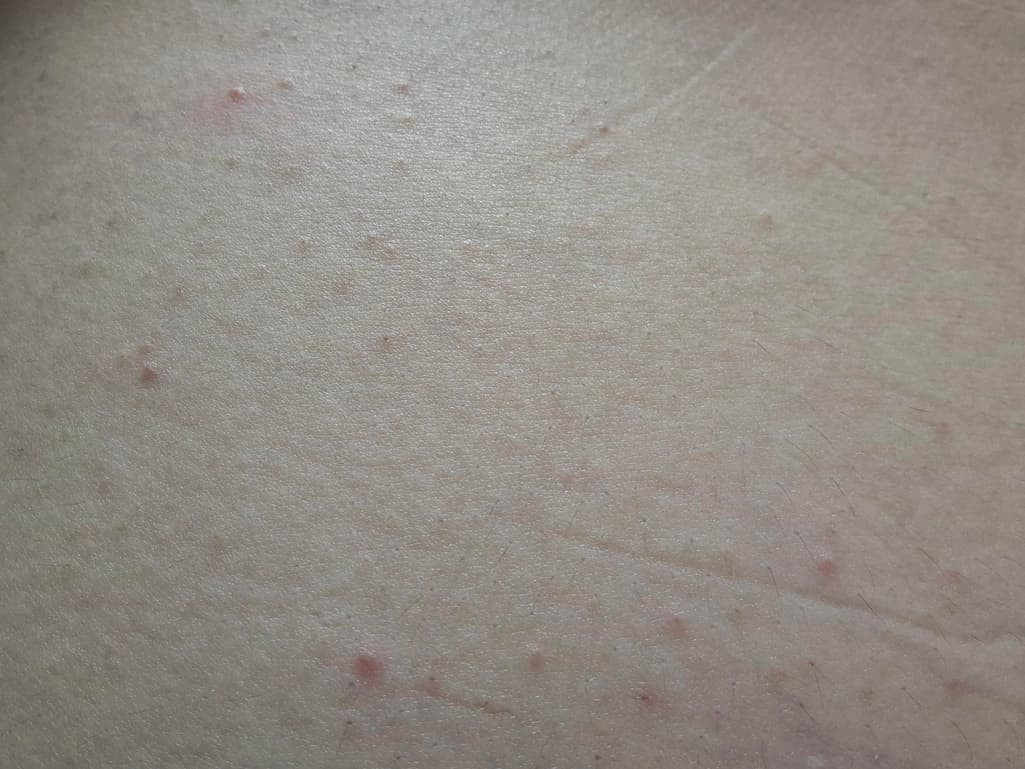 4번 째 사진