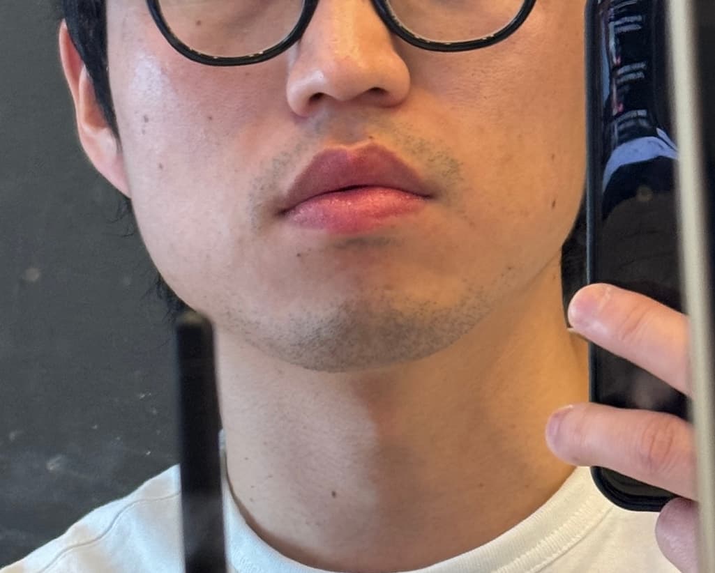 1번 째 사진