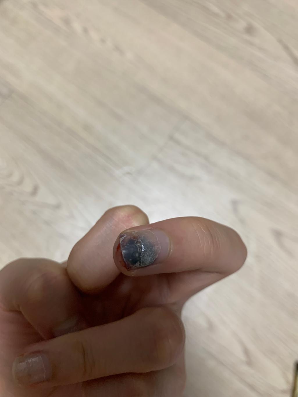 2번 째 사진