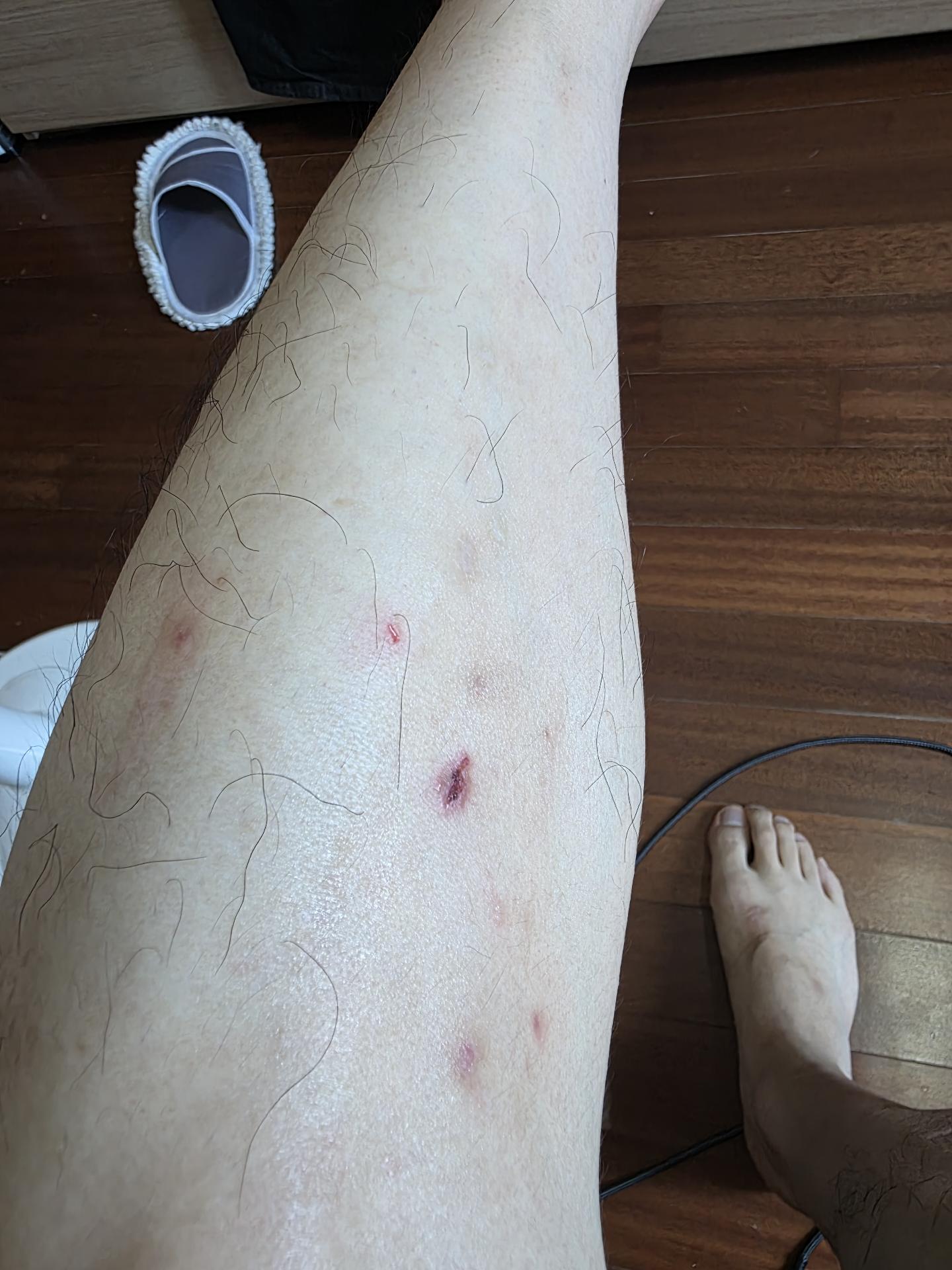 1번 째 사진