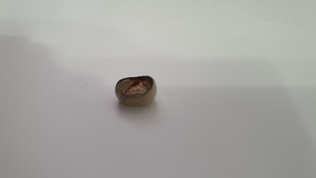 2번 째 사진