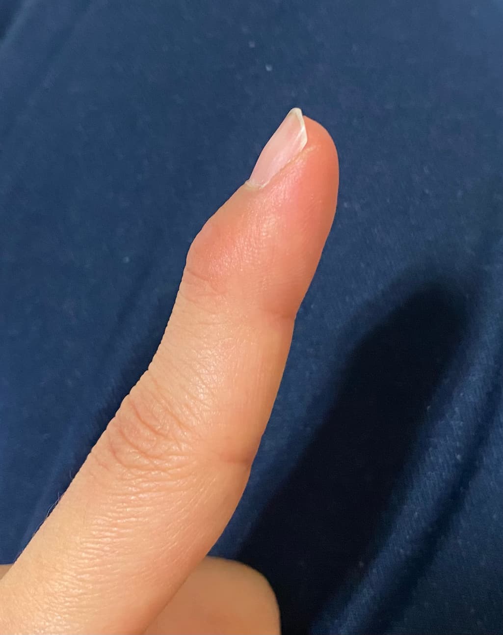 2번 째 사진