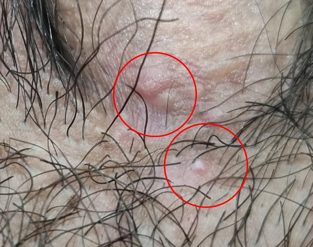 3번 째 사진