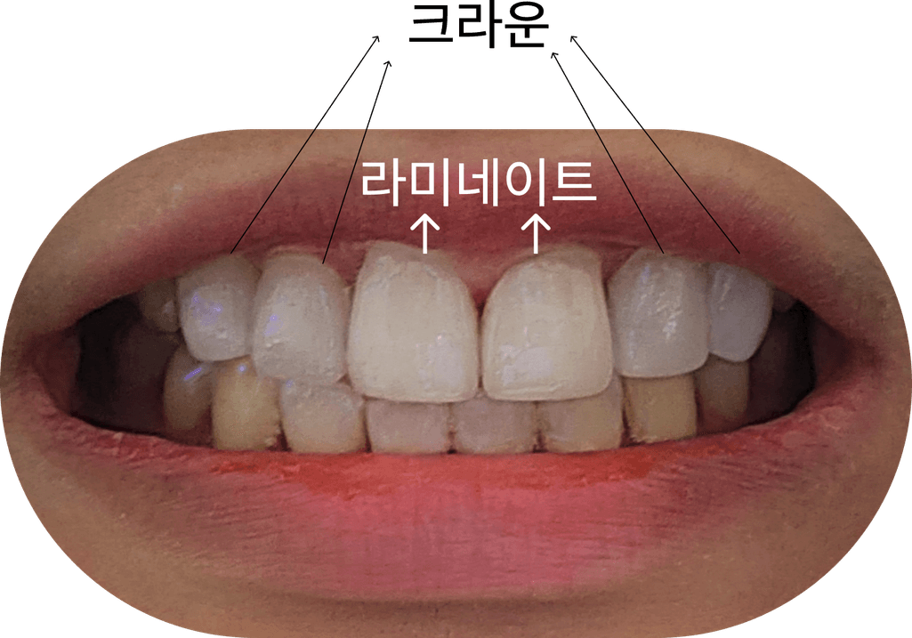 1번 째 사진