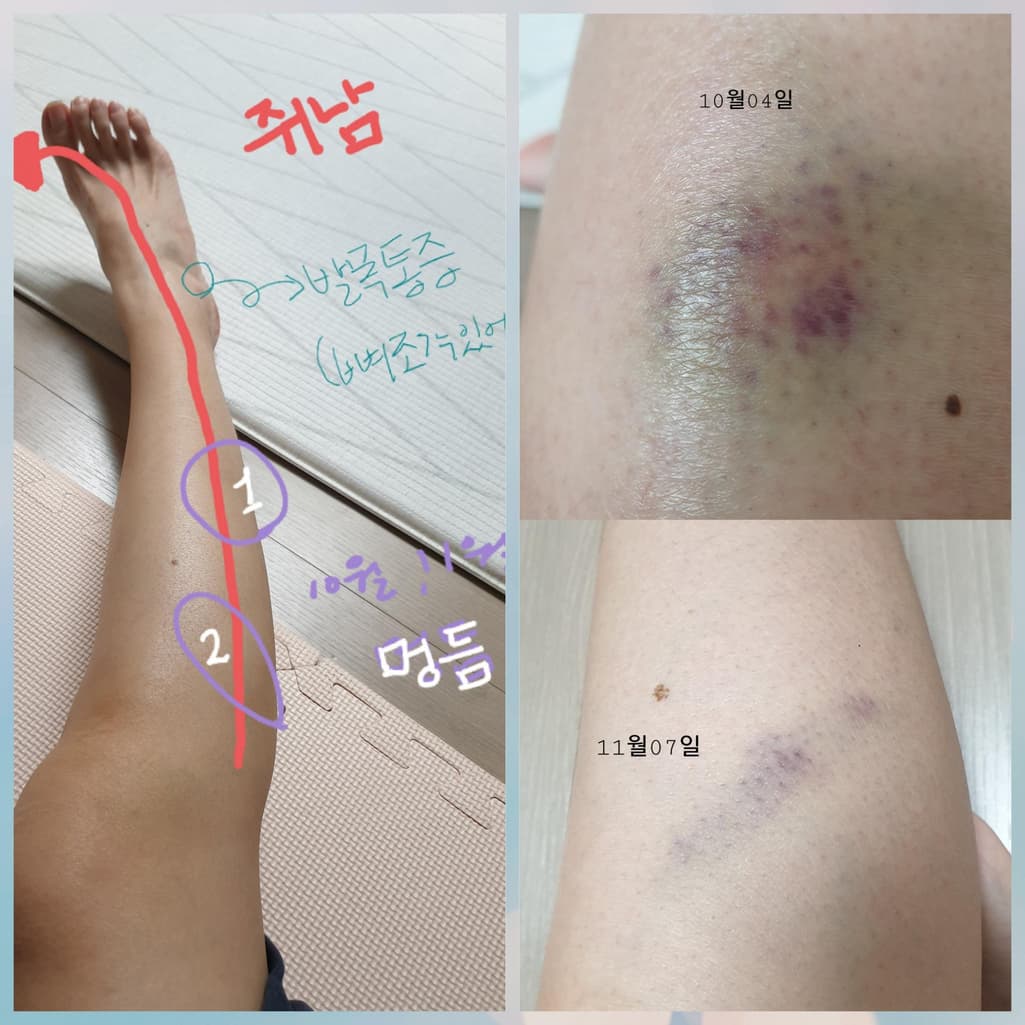 1번 째 사진