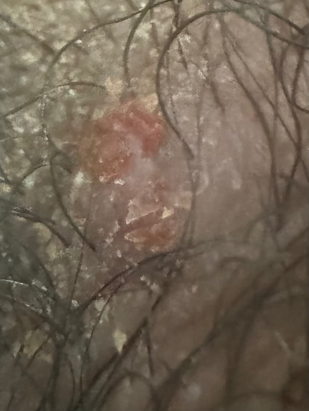 3번 째 사진