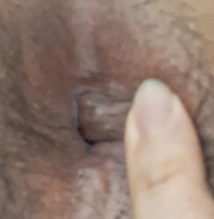 3번 째 사진