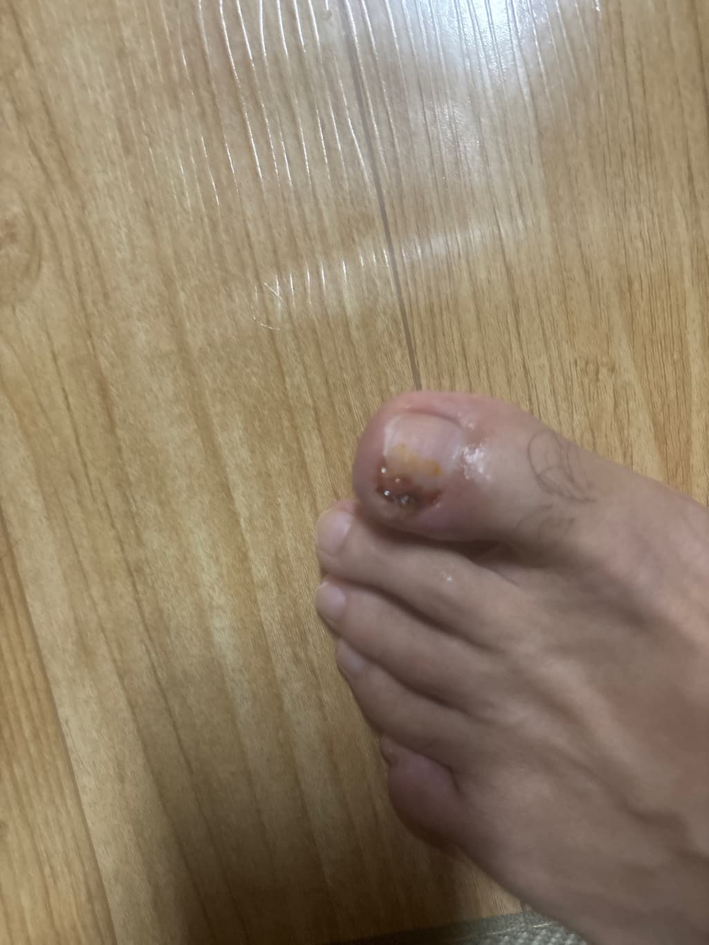 1번 째 사진