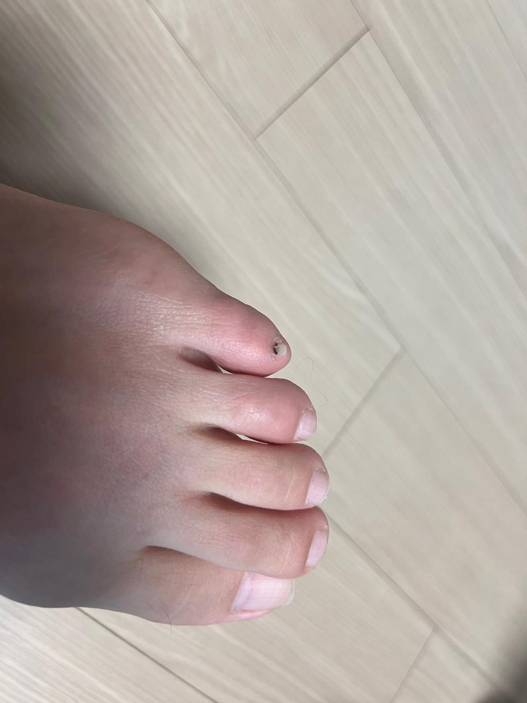 2번 째 사진