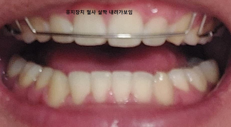 2번 째 사진