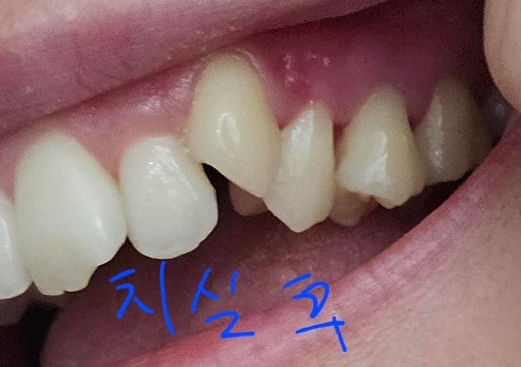 3번 째 사진