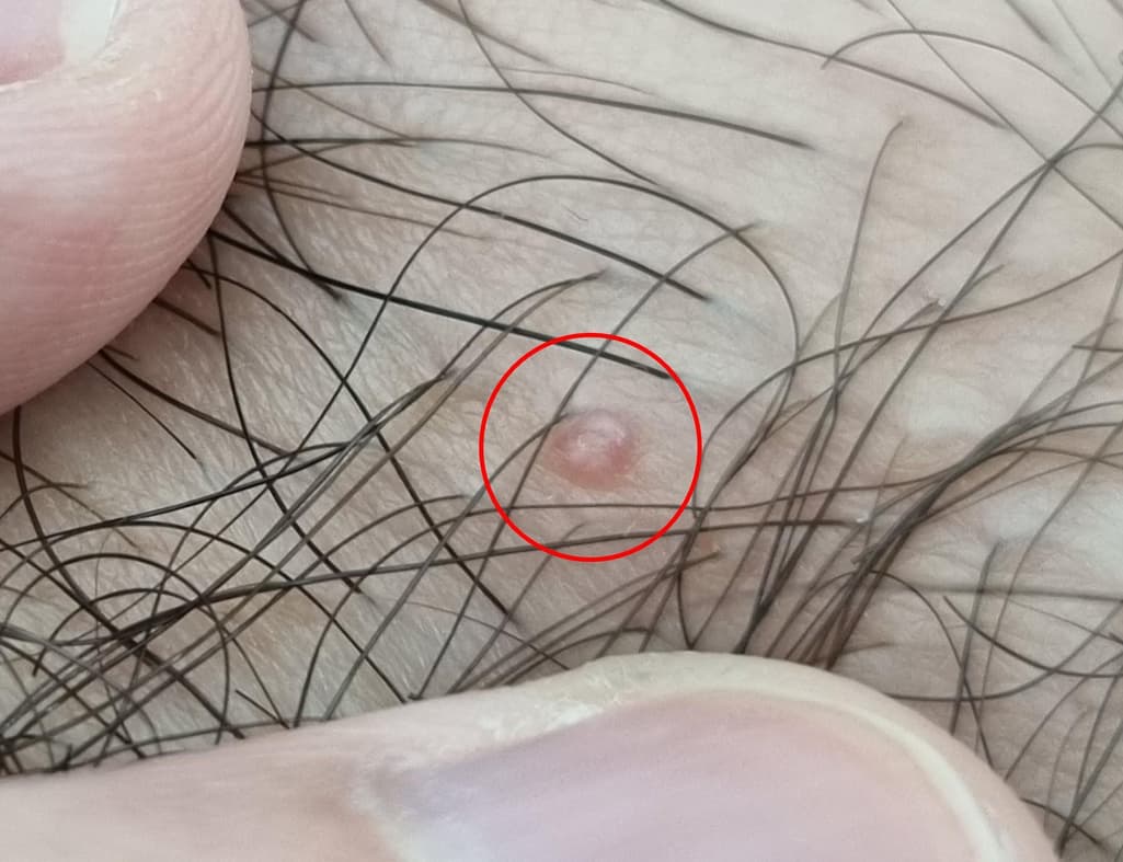 2번 째 사진