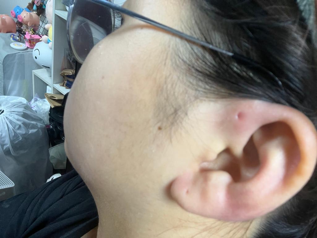 2번 째 사진