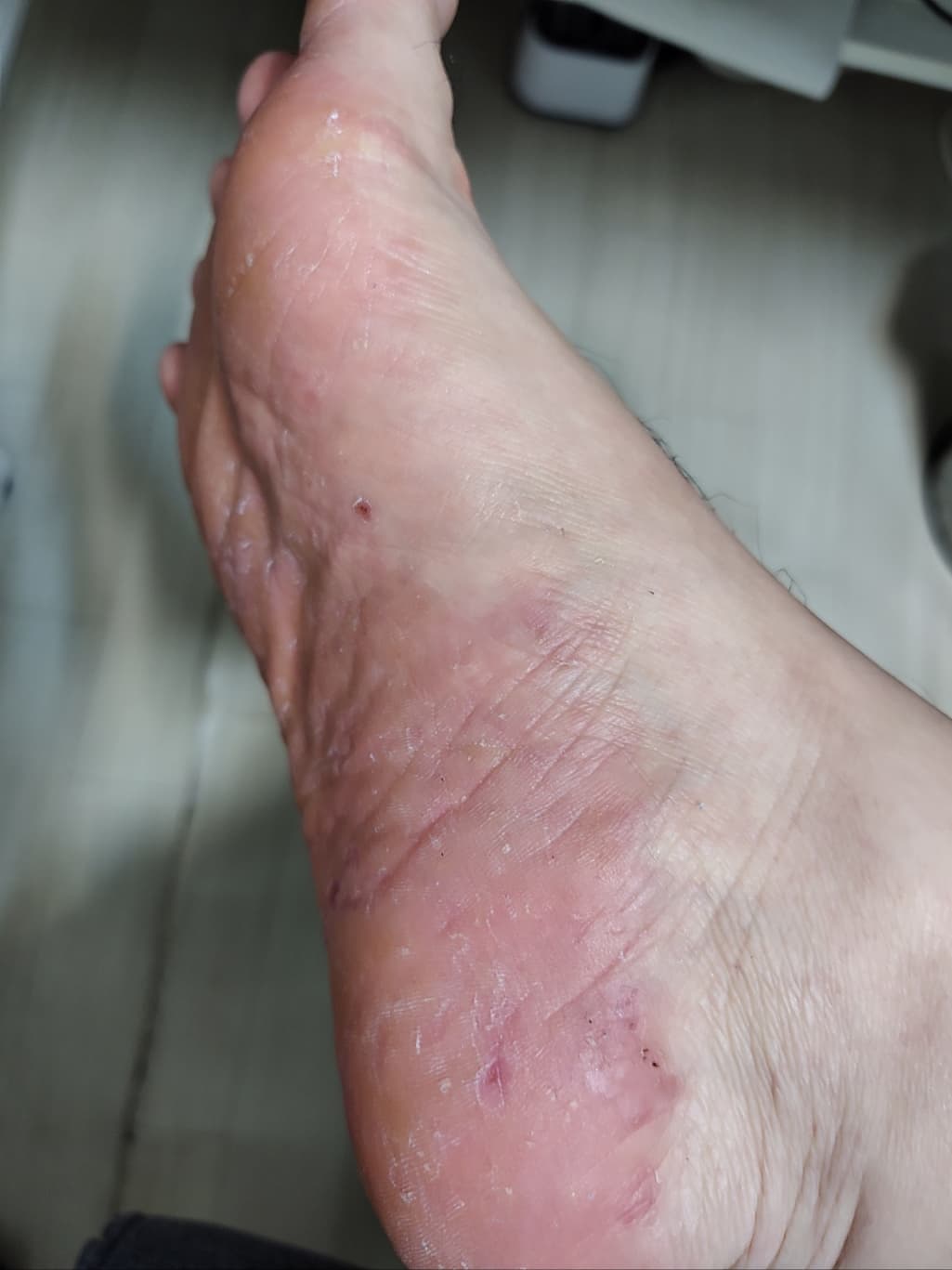 1번 째 사진