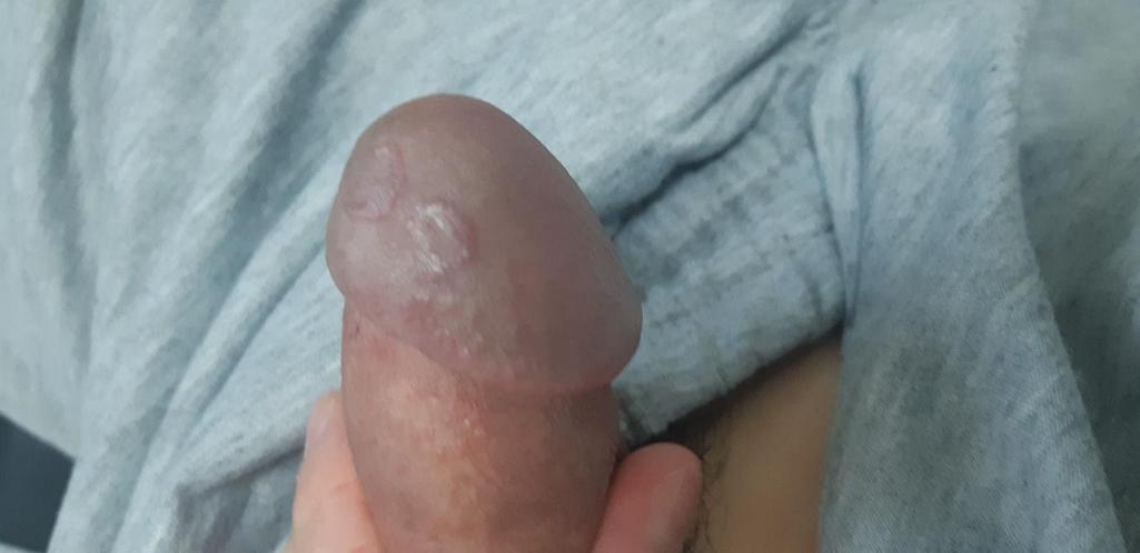 3번 째 사진