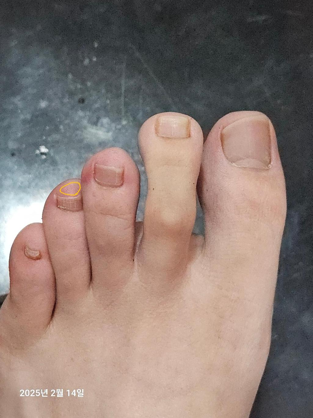 1번 째 사진