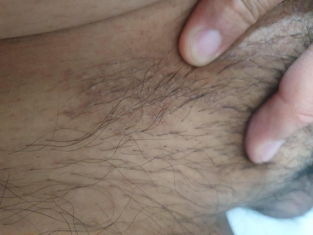 3번 째 사진