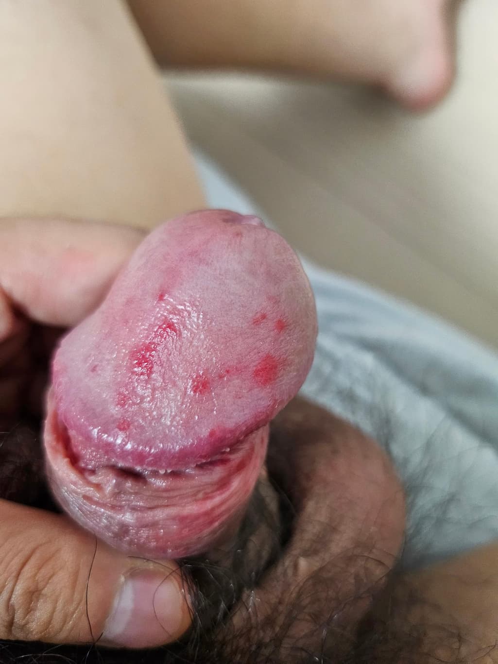 2번 째 사진