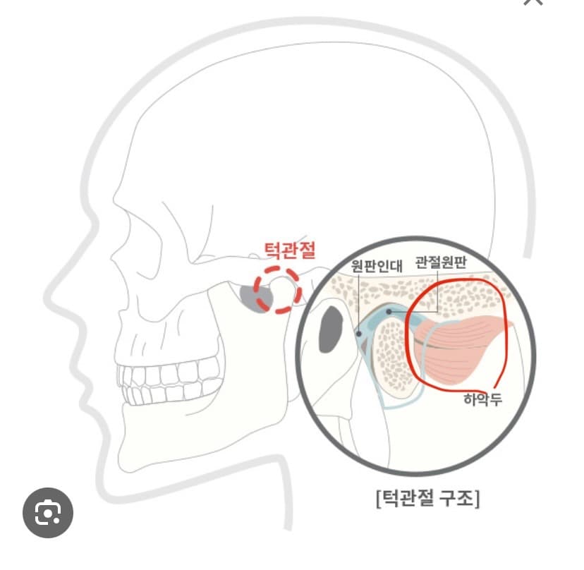 2번 째 사진