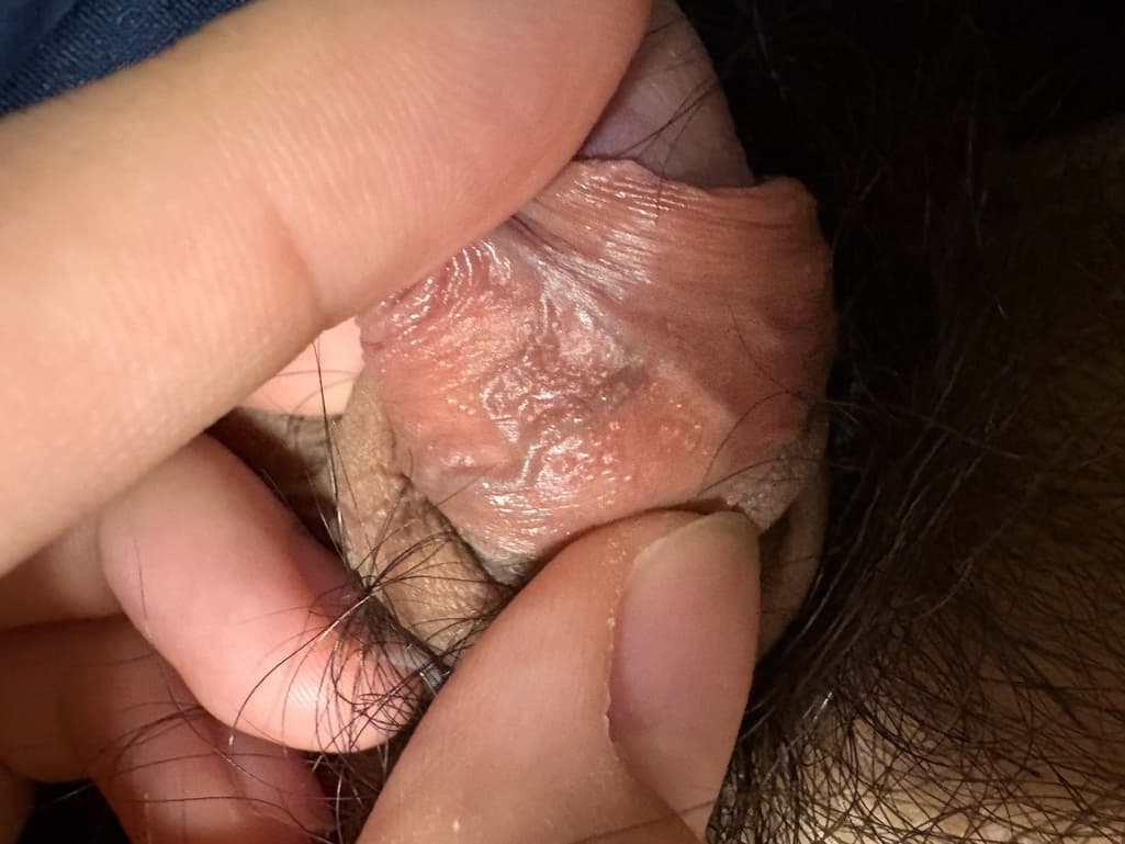 2번 째 사진