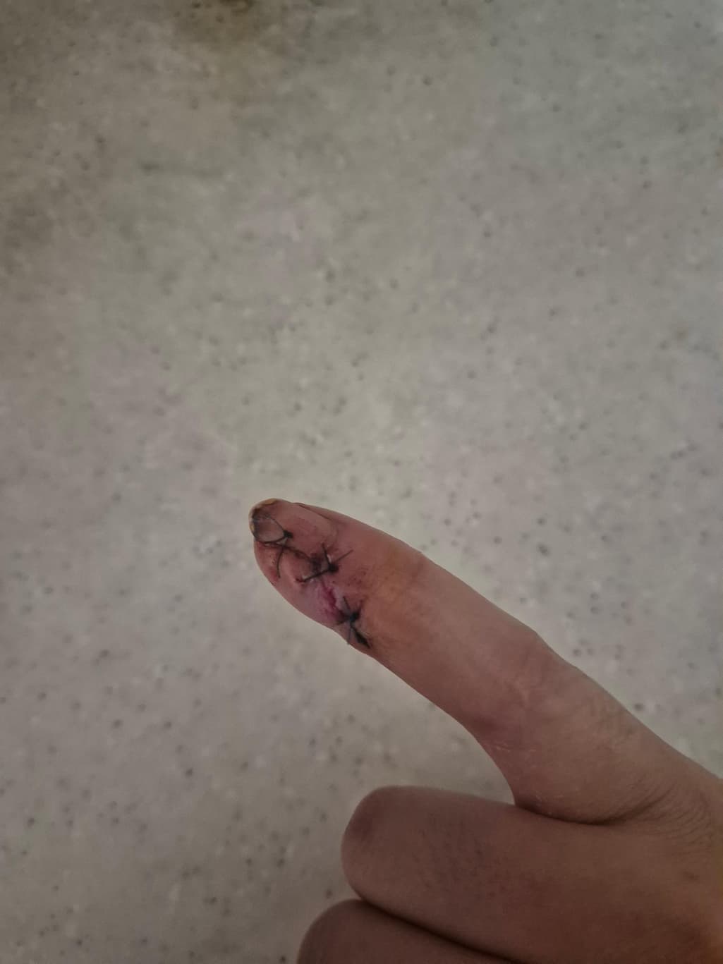 1번 째 사진