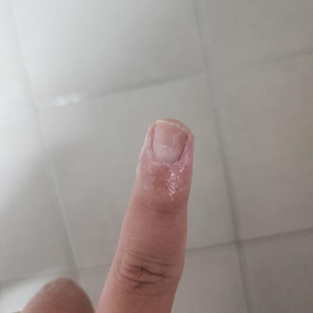 2번 째 사진