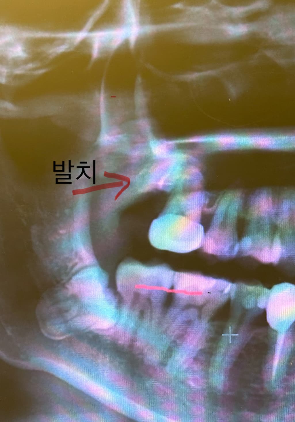 1번 째 사진
