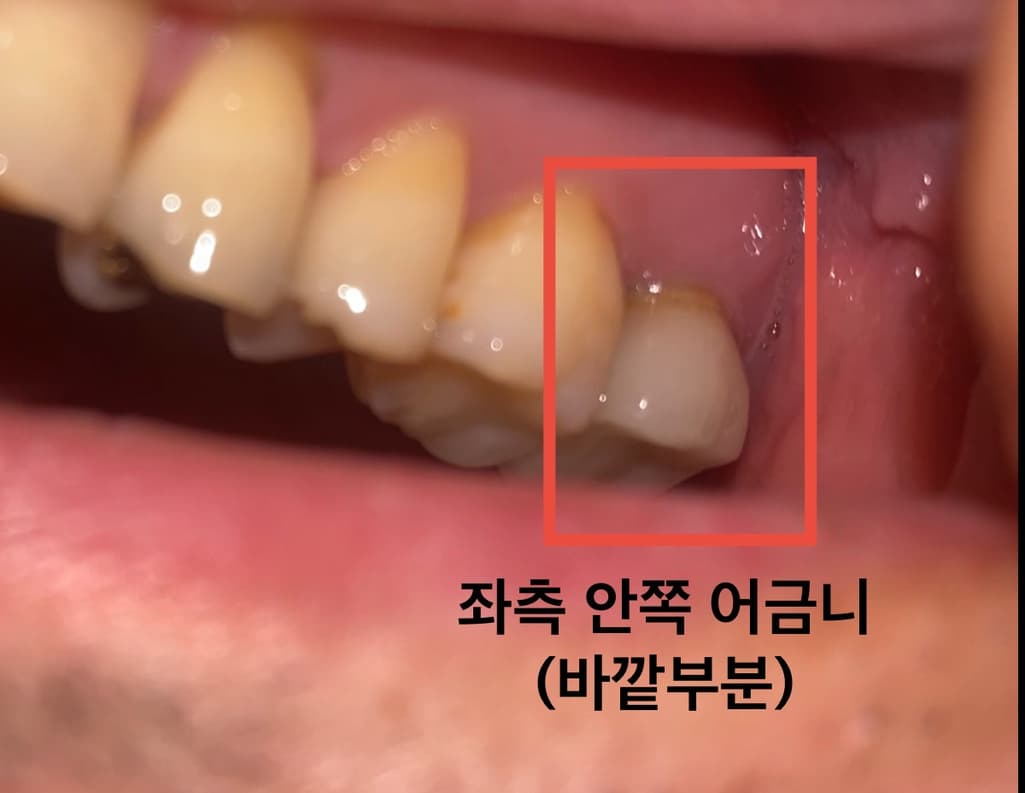 2번 째 사진