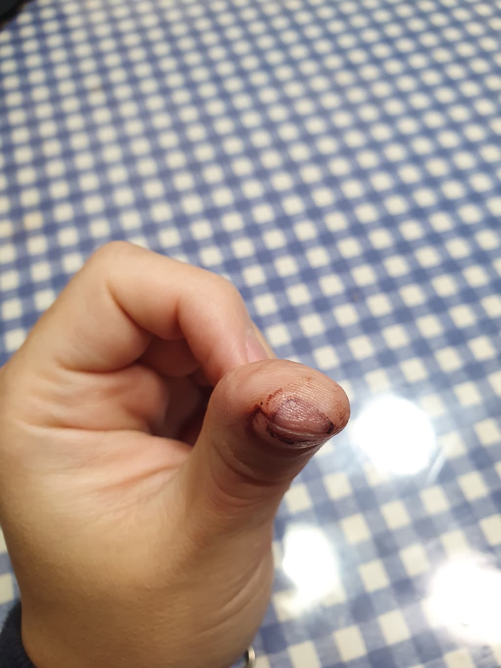 1번 째 사진