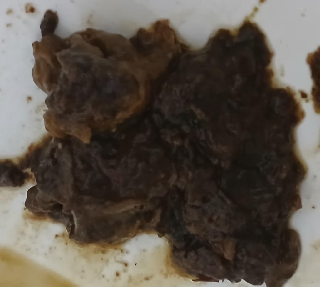 2번 째 사진