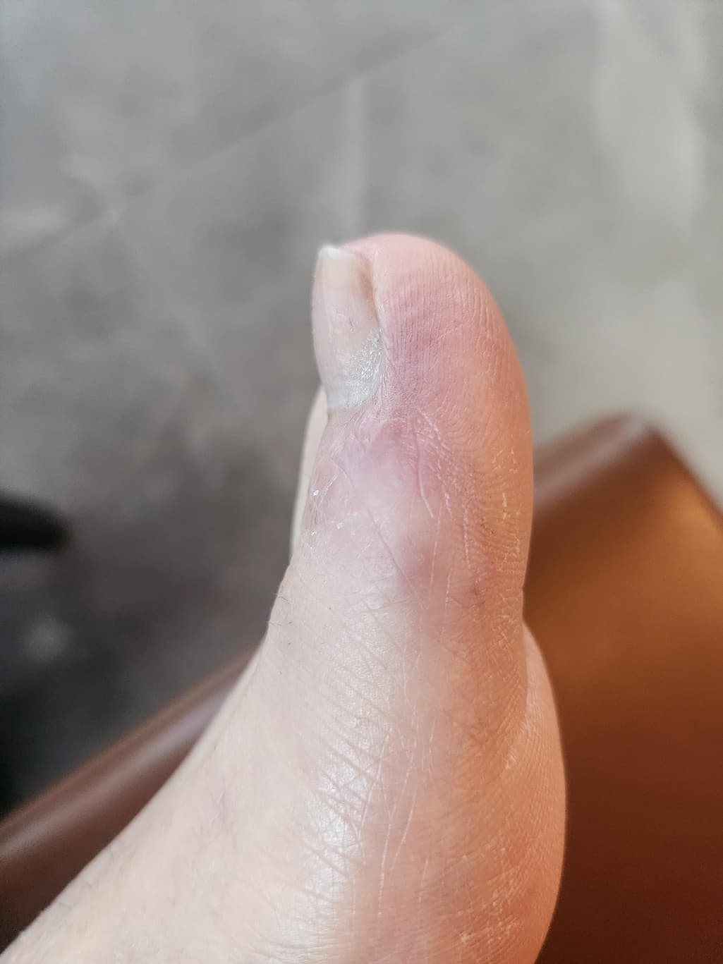 2번 째 사진