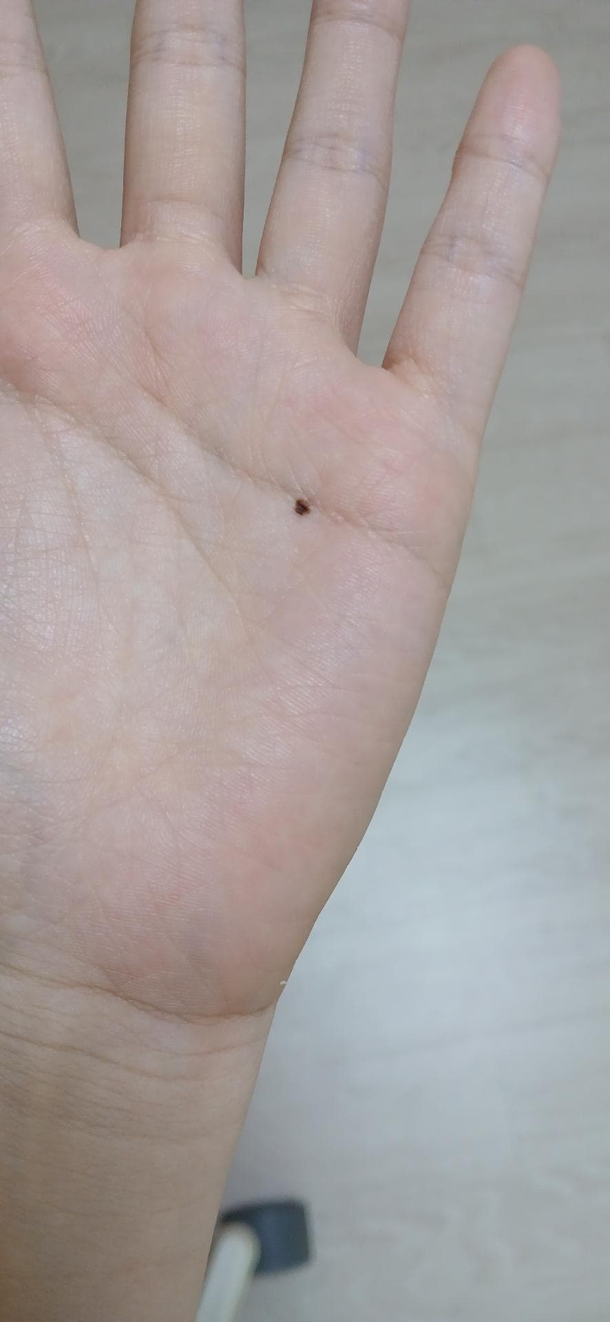 2번 째 사진