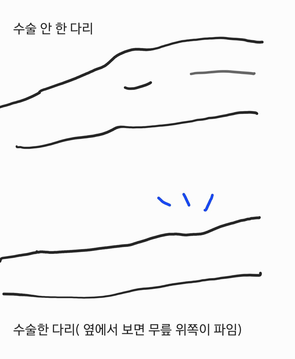 2번 째 사진