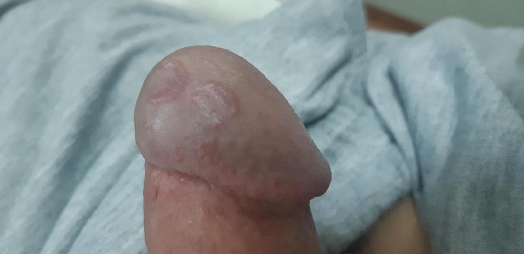 2번 째 사진