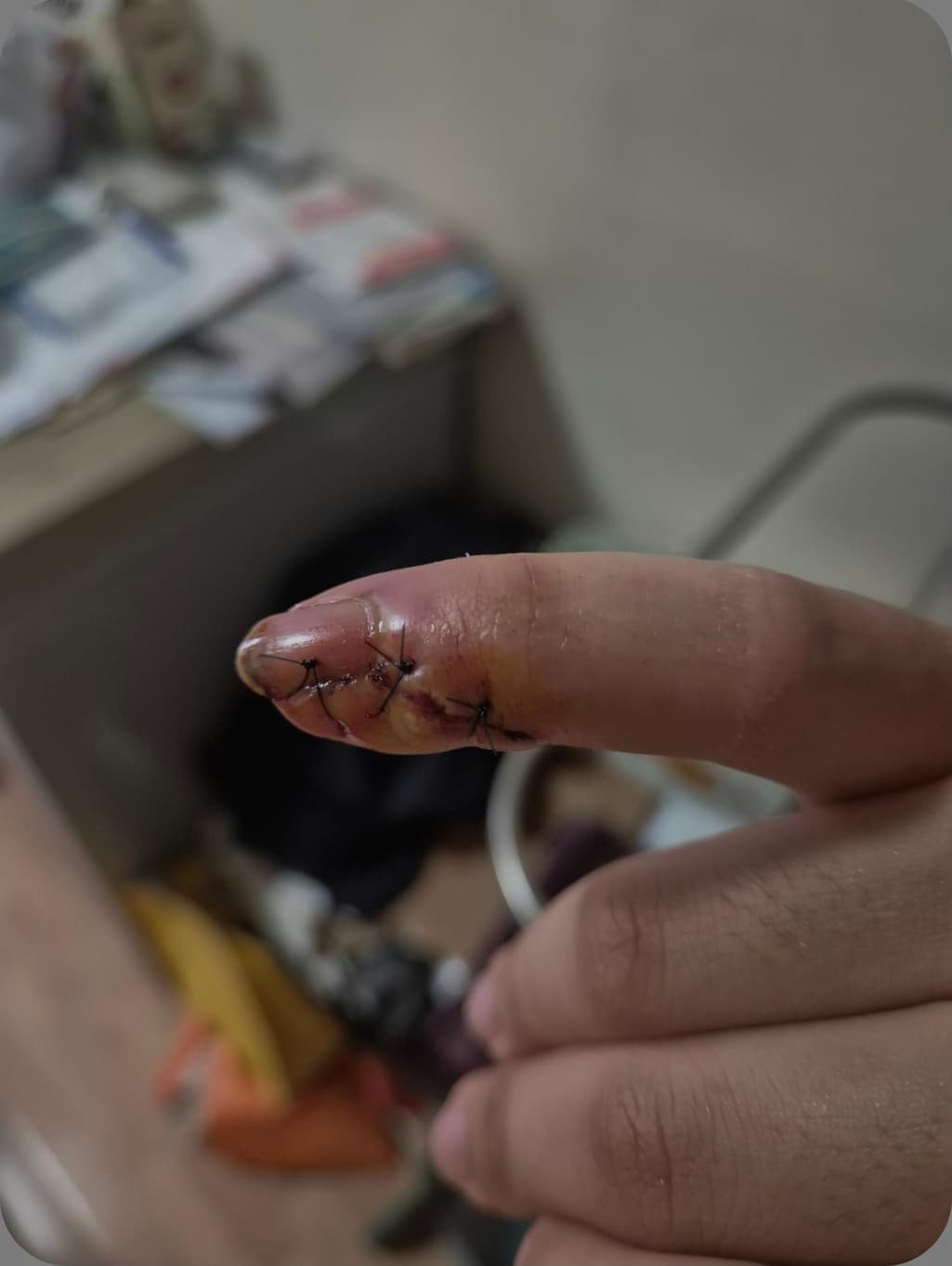 2번 째 사진