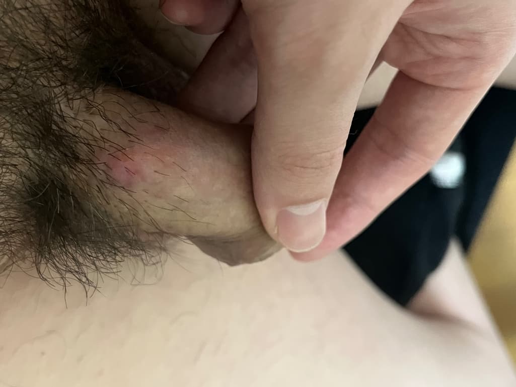 3번 째 사진