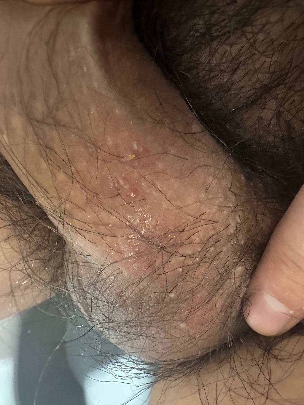 2번 째 사진