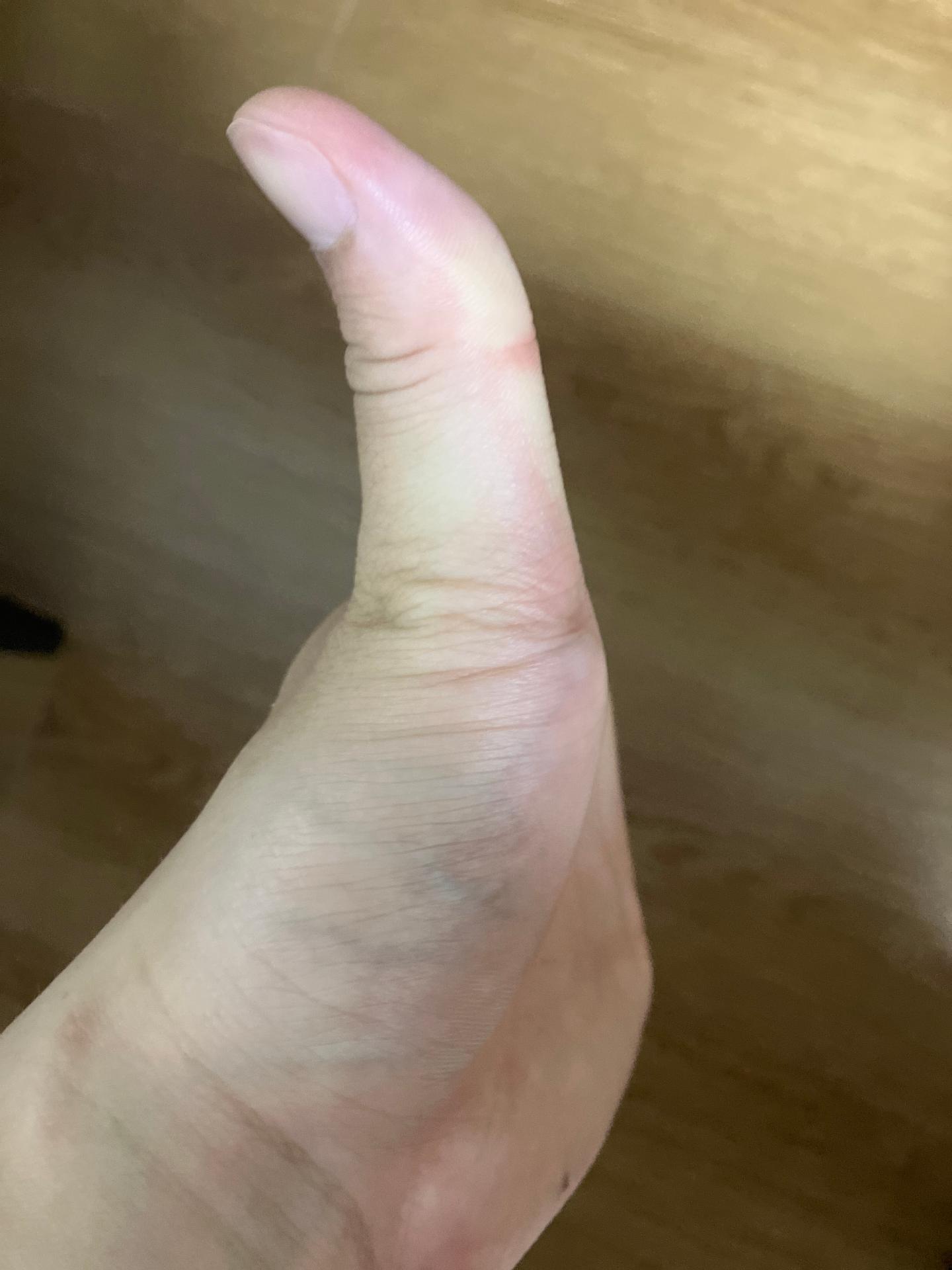 2번 째 사진