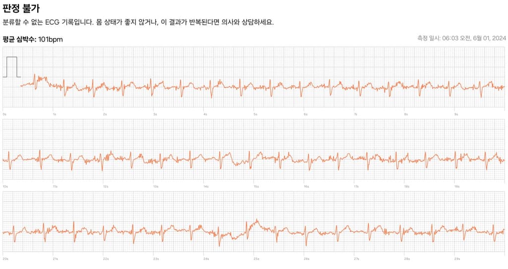 2번 째 사진