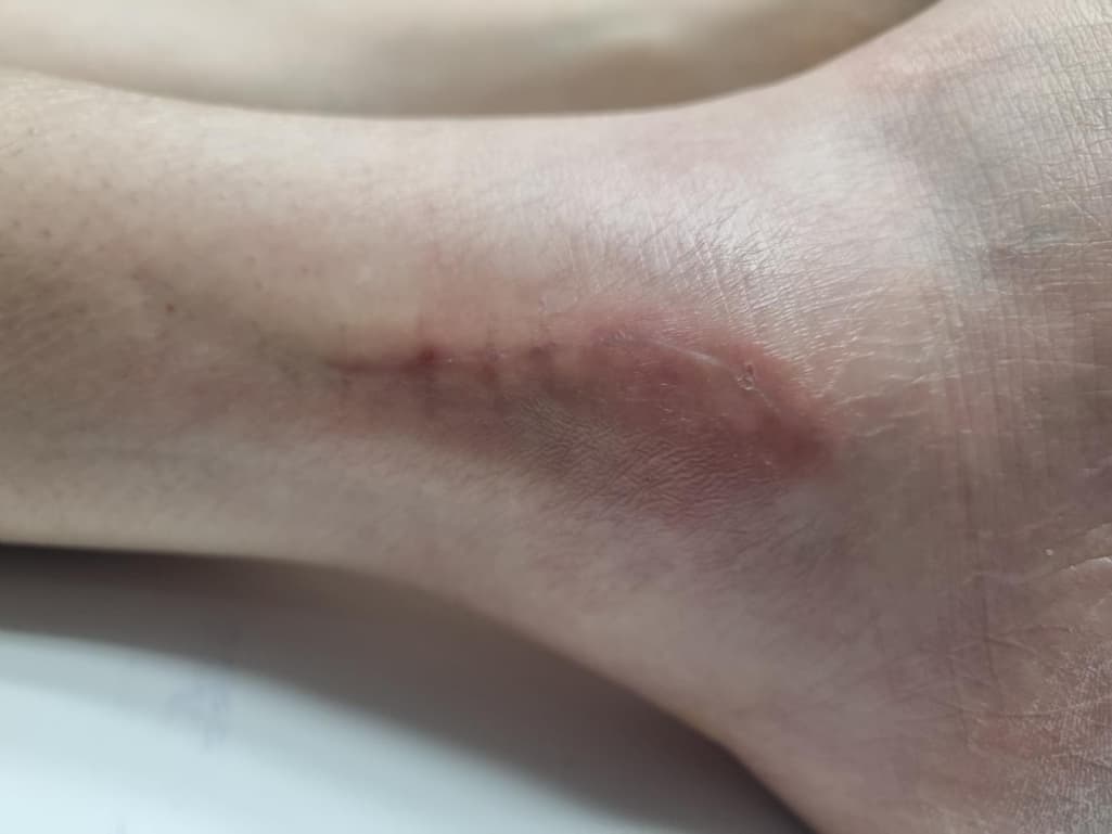 4번 째 사진