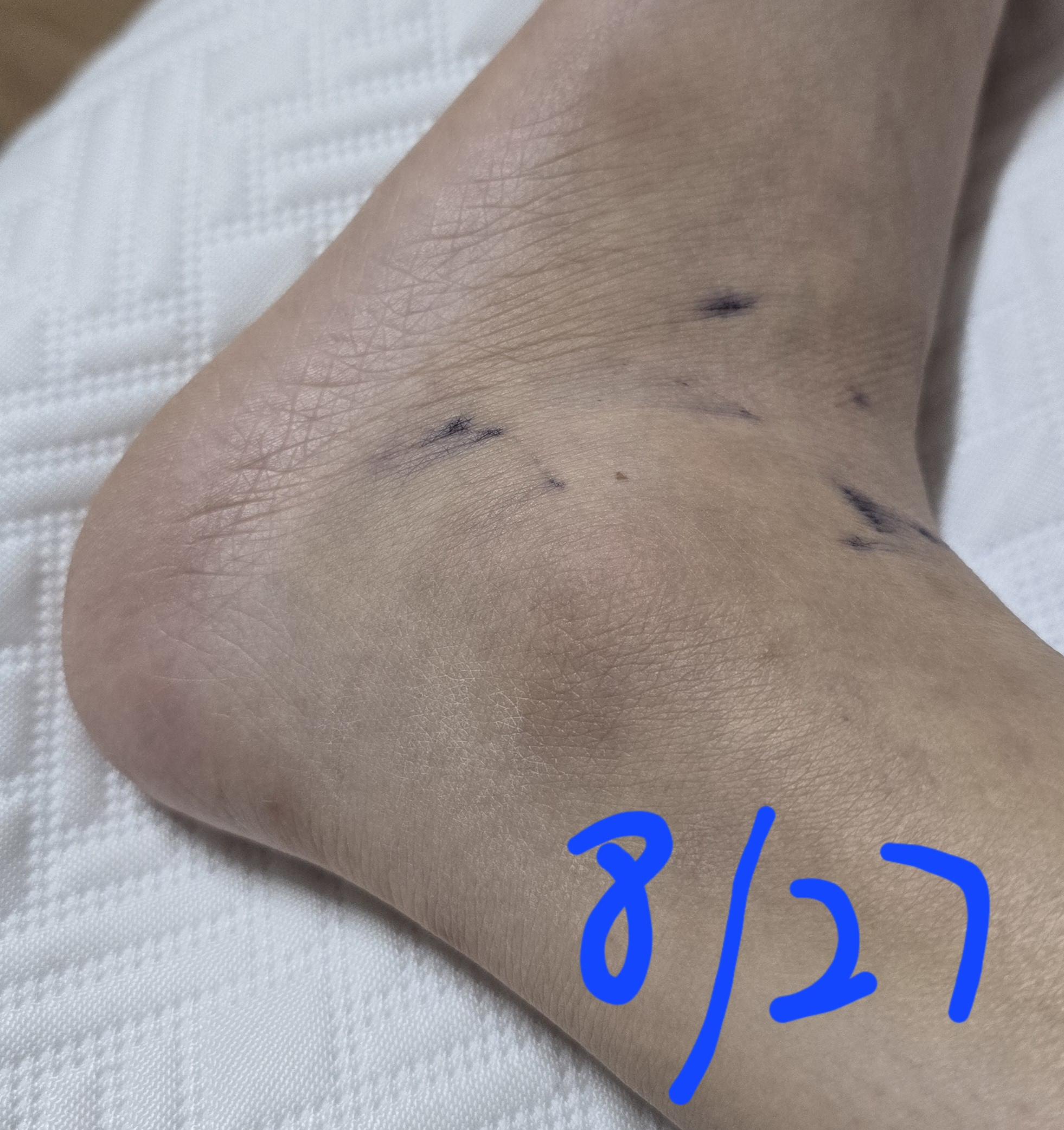 3번 째 사진