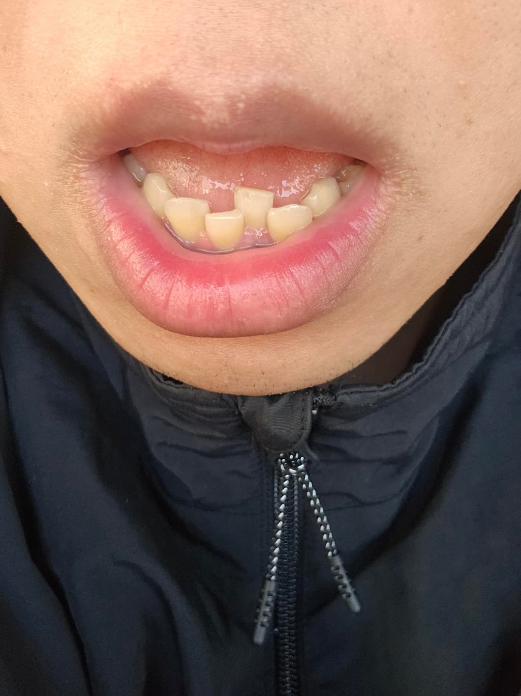 2번 째 사진