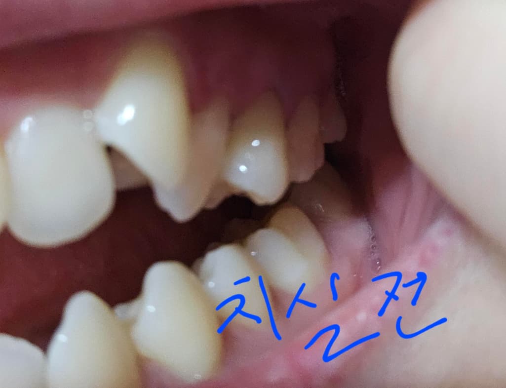1번 째 사진