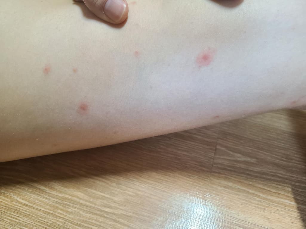 2번 째 사진