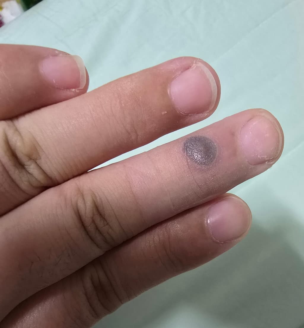 3번 째 사진