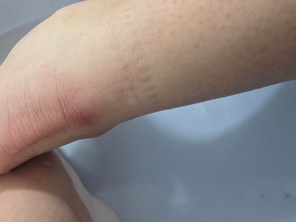 2번 째 사진
